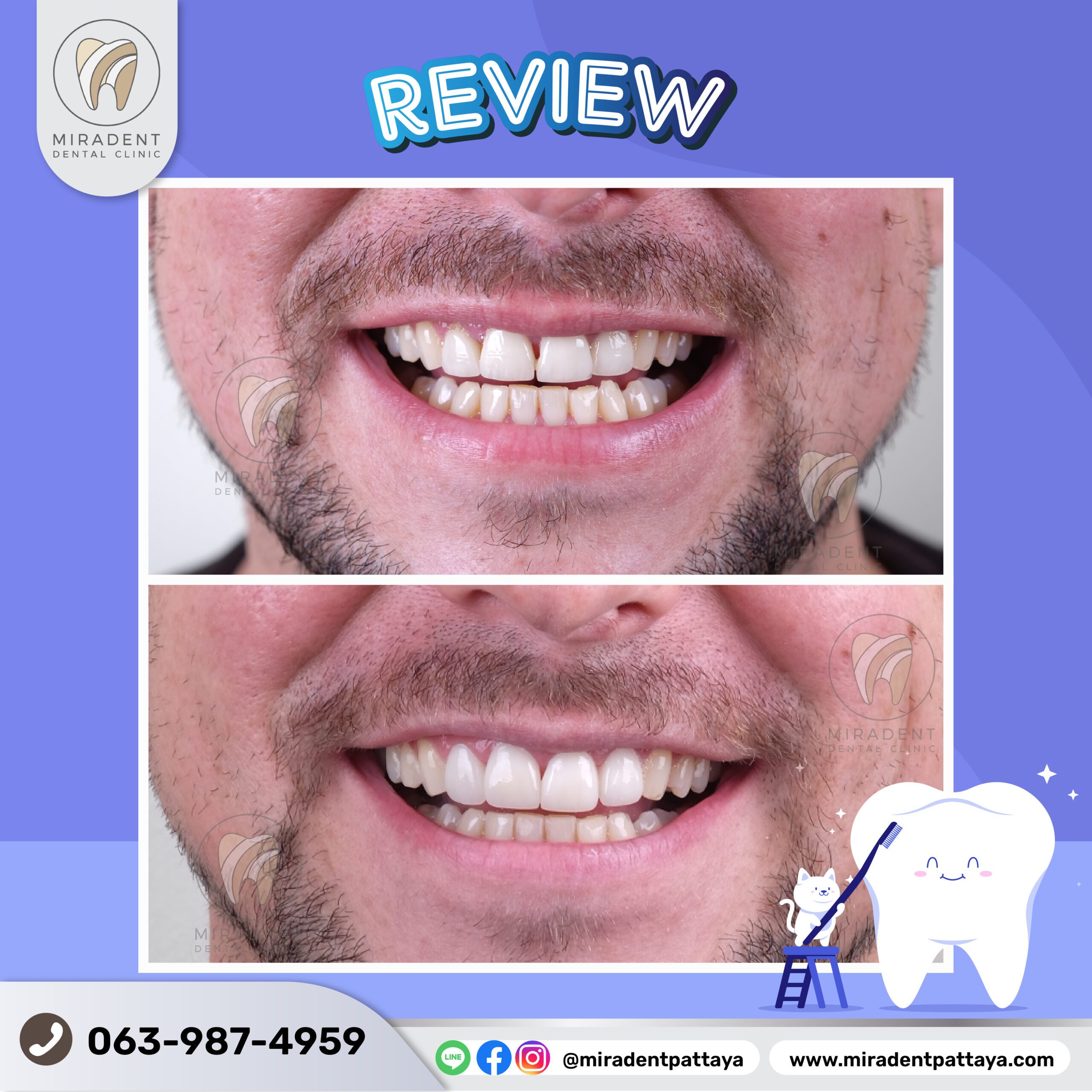 Before-after2